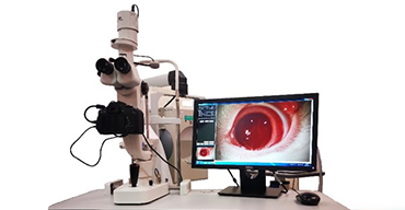 数码裂隙灯(YZ5T裂隙灯显微镜)