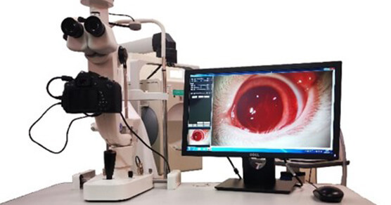 数码裂隙灯(YZ5T裂隙灯显微镜)