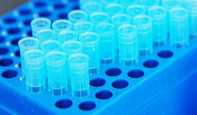 重组激酶制备.jpg 重组激酶制备.jpg