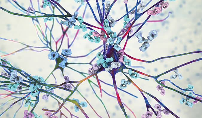 镇痛模型.jpg 镇痛模型.jpg